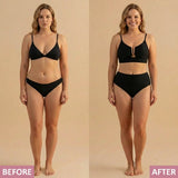 NORA - CORRECTIVE U-WIRE BIKINI